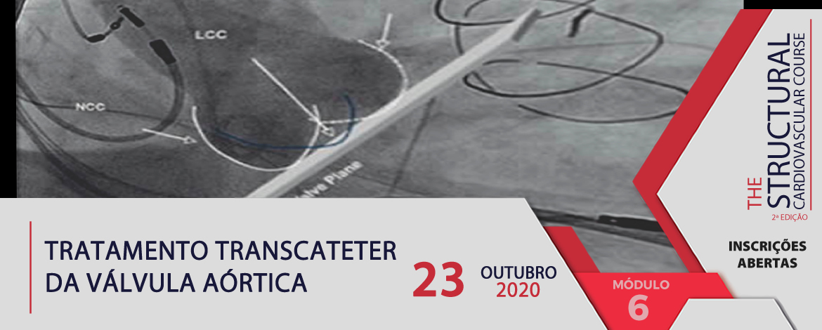 Tratamento Transcateter da Válvula Aórtica - TAVI